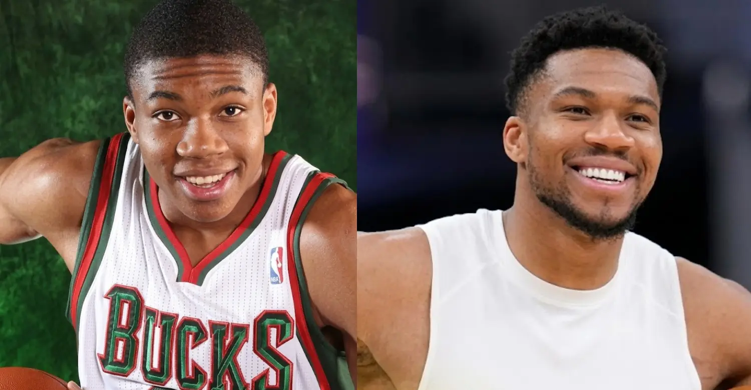 giannis antetokounmpo teeth